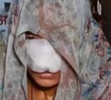 Uttar Pradesh Man Phool Bites Wifes Nose Off After Argument