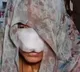 Uttar Pradesh Man Phool Bites Wifes Nose Off After Argument