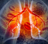 USC Study Links Pesticides to Lung Cancer in Young Non Smokers