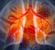 USC Study Links Pesticides to Lung Cancer in Young Non Smokers