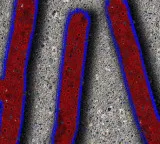 Concerns raised over rise in HIV cases at Pakistan Institute of Medical Sciences