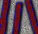 Concerns raised over rise in HIV cases at Pakistan Institute of Medical Sciences