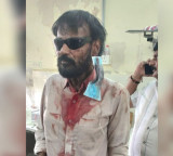 Duscharla Satyanarayana Attacked by Shepherds in Suryapet