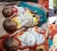 Mother of 4 welcomes triplets in rare normal delivery in Madhya Pradesh