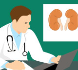 New study says drinking more water not a sollution for kidney stones