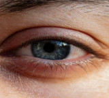 Eye Stroke What You Need to Know About Symptoms and Risks