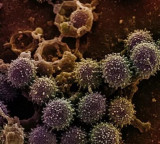 WHO Clarifies Hanta Virus Not Like COVID19 or Flu