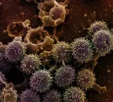WHO Clarifies Hanta Virus Not Like COVID19 or Flu