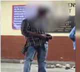 Rohit Pawar Mumbai Man Stands Talking on Phone with Knife in Head