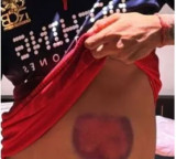 Krunal Pandya Shows Injuries After Match Winning Innings