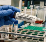 Hantavirus Scientists Were Close To Vaccine But Ran Out of Money