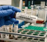 Hantavirus Scientists Were Close To Vaccine But Ran Out of Money