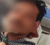 Madya Pradesh Farmer Mutilates Himself With Axe To Become An Ascetic