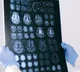 Magic Mushrooms result in recovery after five years of memory loss
