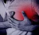 Heart attack study reveals 99 percent of cases caused by four main factors