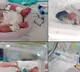 Australian couple blessed with quadruplet girls face new logistical challenges