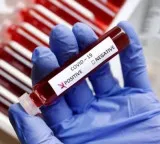 COVID 19 alert in Hyderabad as patients flock to hospitals with symptoms