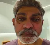 Jagapathi Babu with injuries on face actor clarifies what happened