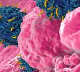 World first breakthrough treatment for cancer tumors