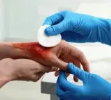 Wounds vanish without stitches IICT new innovation