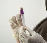Parliamentary Panel suggests mandatory kidney tests for those over 20 to Center