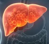 Fatty Liver problems without symptoms how to identify and treat early