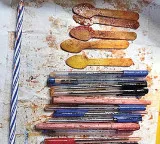 Palnadu woman goes for chest pain doctors find 14 pens and 5 spoons in her stomach