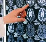 Do we use only 10 percent of our brain how much truth is in this long standing claim