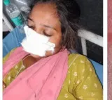 Husband bites wifes nose in Mancherial atrocity