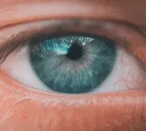 Are these eye changes signs of a heart attack