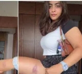 Zayn Marie Khan posts video showing injuries sustained during Mumbai protest