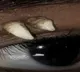 Tooth in eye rare incident in medical history doctors stunned