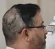 Captain Smith Machar head injury photo shared by AP BJP