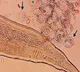 Elderly man visits hospital for vision loss worms moving in eyes doctors shocked