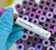 Four people died in Telangana due to corona