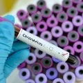 AP gets more corona positive cases
