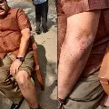 Kodali Nani is behind attack on me says TDP leader Pattabhi