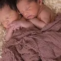 Conjoined twins separated at AIIMS after 24hour surgery