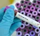 Government doctor cheats officials in Madhyapradesh