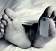 another two died in Eluru mystery illness case