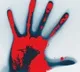 Man Sprays Sanitiser On Employes Genitals