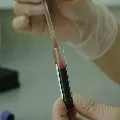 Plasma Therapy could not stop corona deaths