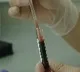 Plasma Therapy could not stop corona deaths