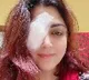 I had to go under a knife for my eye khushbu