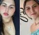 Twins Undergo Gender Confirmation Surgery Together A First