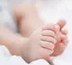 Baby Born With Three Legs In Nuziveedu Hospital