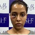 Raiza Wilson alleges skin care expert damages her face with false treatment
