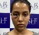 Raiza Wilson alleges skin care expert damages her face with false treatment