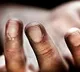 man begs with deadbody in kamareddy