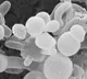 White fungus is more dangerous than Black fungus